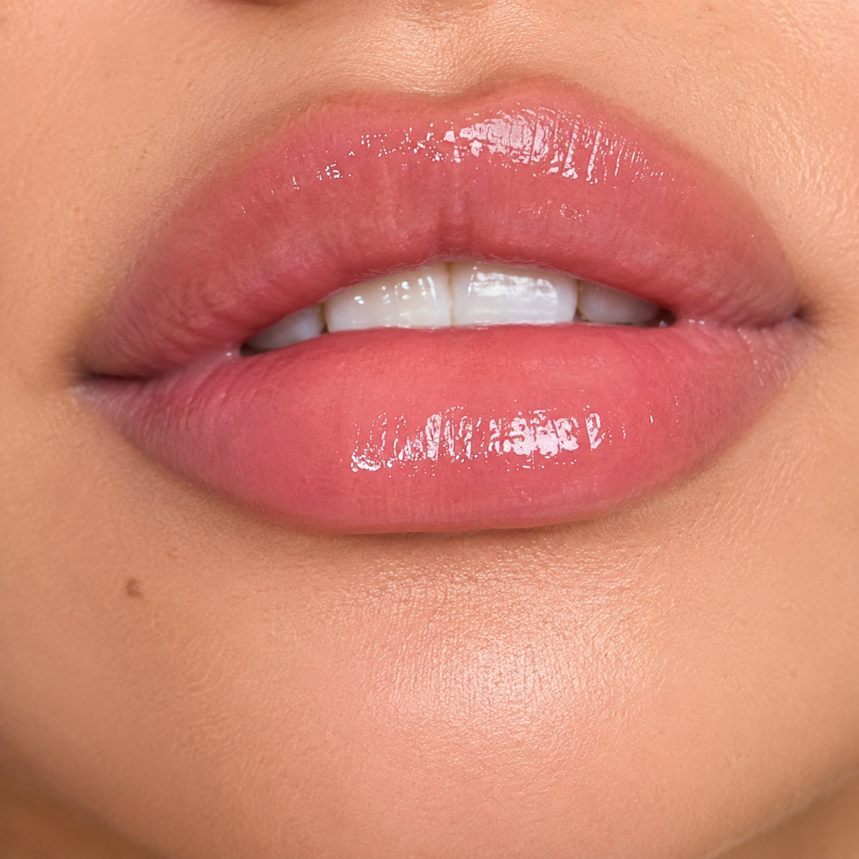 Labios